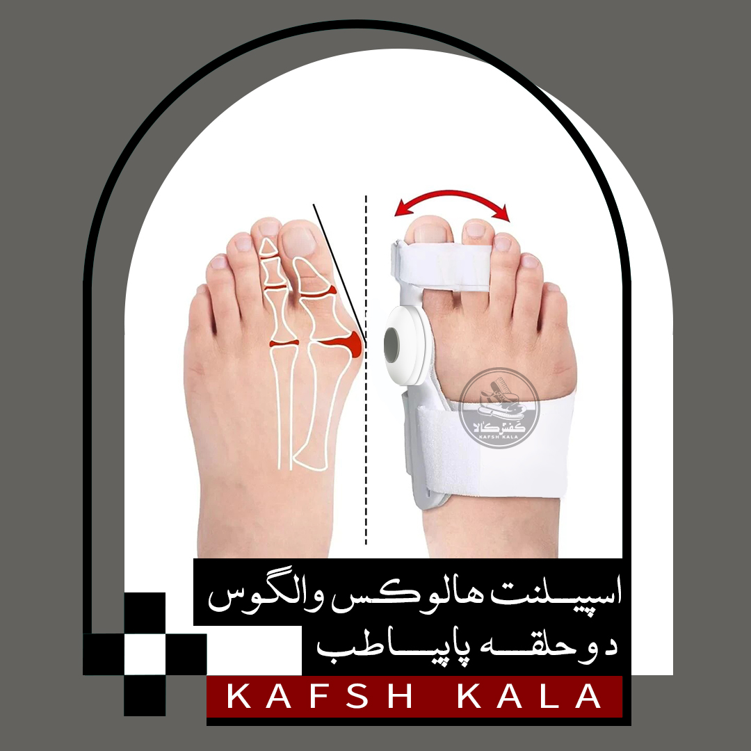 اسپیلنت مفصل دار هالوکس والگوس دوحلقه
